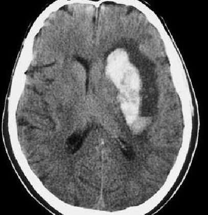 Jornada sobre ACV en el Lucio Molas