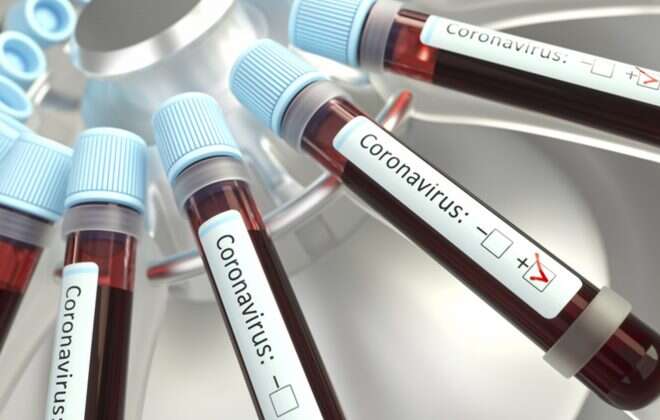 COVID-19: 3 muestras positivas. Sólo 2 pertenecen a La Pampa