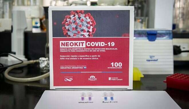 Científicas y científicos del CONICET lideraron el desarrollo del NEOKIT-COVID-19