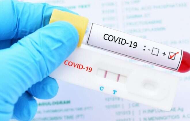 Covid-19: 113 muestras analizadas, 5 positivos que se encuentran aislados y 4415 personas aisladas en la provincia