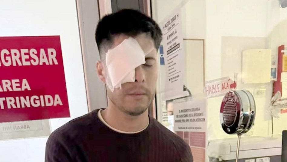 Cosquín: un pampeano sufrió una grave lesión ocular tras ser impactado por pirotecnia en un festival